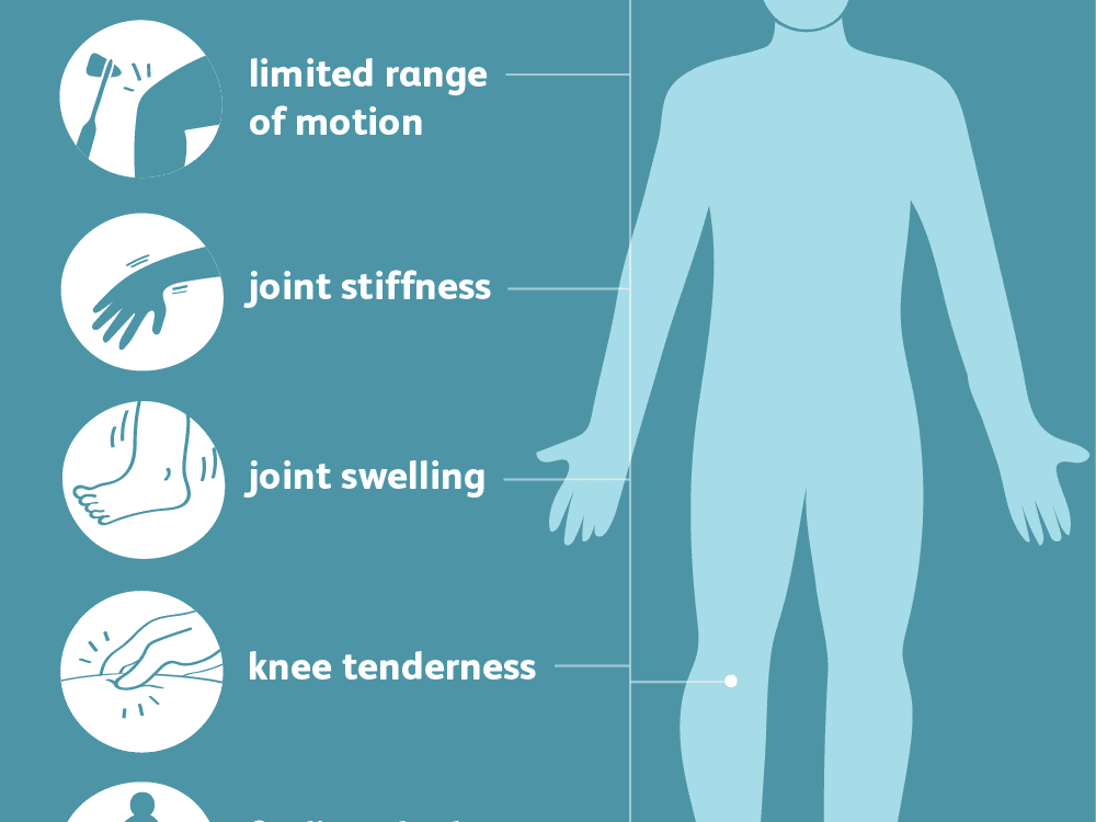 Arthritis: Causes, Symptoms and Treatment